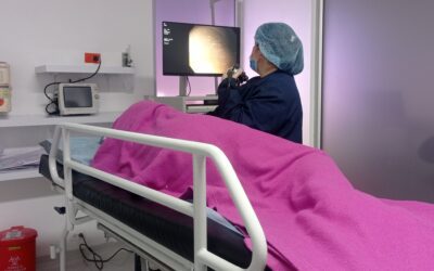 ¿Cuándo se debe realizar una colonoscopia?