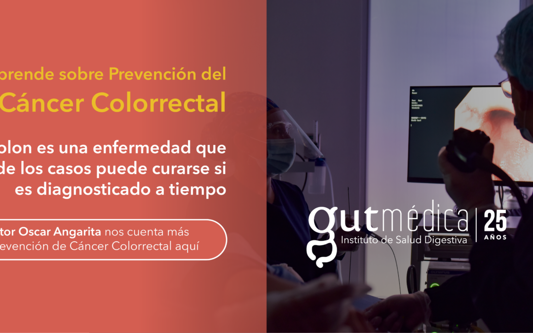 ¿Como prevenir el cáncer de colon?